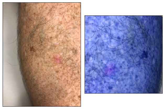 Skin Cancer Classification Research